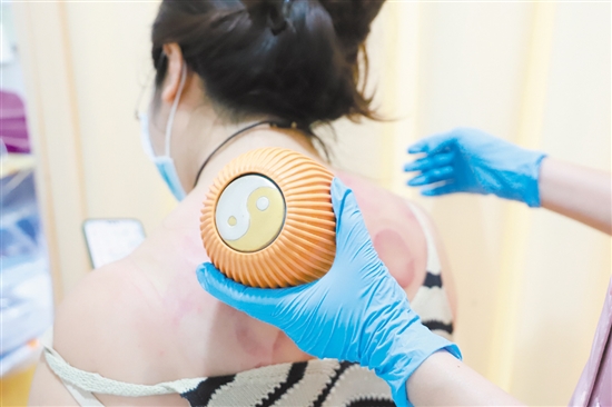 醫(yī)護(hù)人員在夜間門診為患者拔火罐。