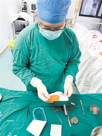 醫(yī)生在準備TYRX可吸收抗菌封套。