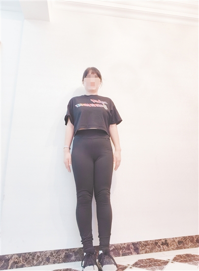 高女士減脂前后對比。